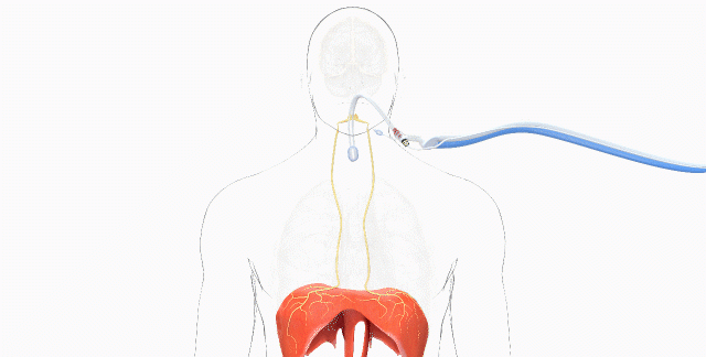 肺泡和血液之间怎样进行气体交换图4